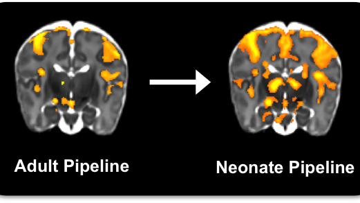 Optimising Neonatal fMRI Data Analysis for noxious-evoked brain activity.